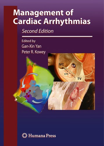 Cover for Management of cardiac arrhythmias