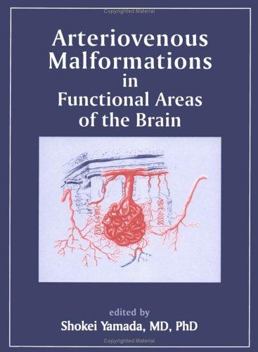 Cover for Arteriovenous malformations in functional areas of the brain