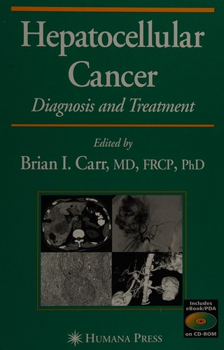 Cover for Hepatocellular cancer