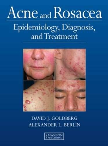 Cover for Acne and Rosacea