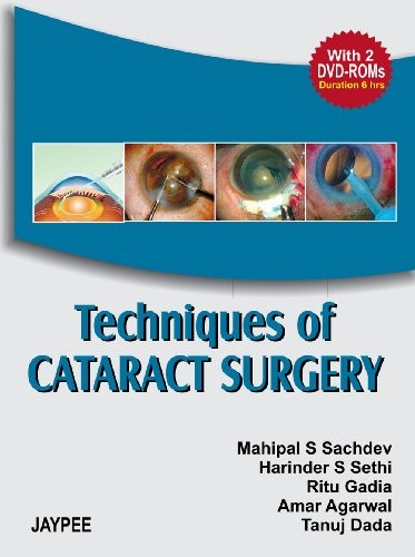Cover for Techniques of Cataract Surgery