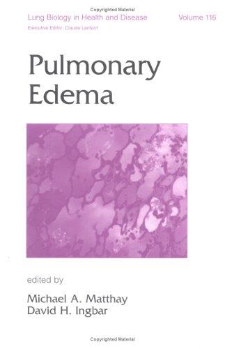 Cover for Pulmonary edema