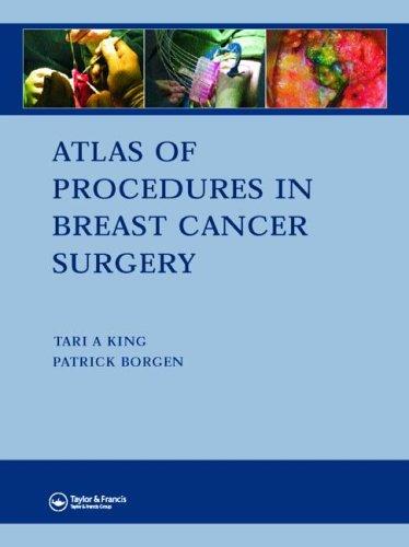 Cover for Atlas of Procedures in Breast Cancer Surgery