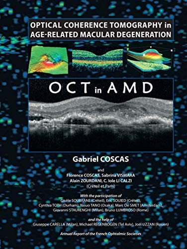 Cover for Optical Coherence Tomography in Age-Related Macular Degeneration