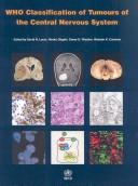 Cover for Who Classification of Tumours of the Central Nervous System (Who Classfication of Tumours)