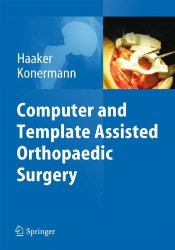 Cover for Computer and Template Assisted Orthopedic Surgery