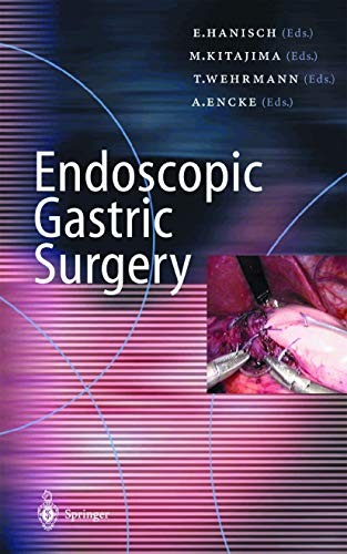 Cover for Endoscopic Gastric Surgery