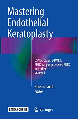 Cover for Mastering Endothelial Keratoplasty