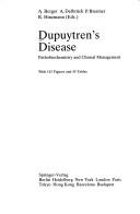 Cover for Dupuytren's disease