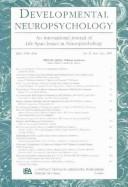 Cover for Williams Syndrome