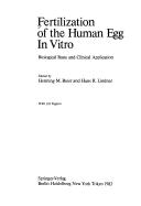Cover for Fertilization of the human egg in vitro