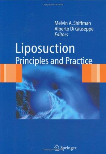 Cover for Liposuction