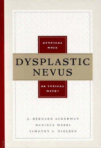 Cover for Dysplastic Nevus