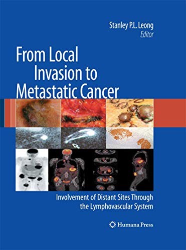 Cover for From Local Invasion to Metastatic Cancer