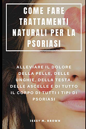 Cover for COME FARE TRATTAMENTI NATURALI PER LA PSORIASI