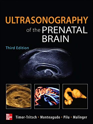 Cover for Ultrasonography of the prenatal and neonatal brain