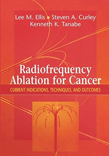 Cover for Radiofrequency Ablation for Cancer