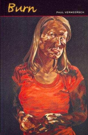 Cover for Burn