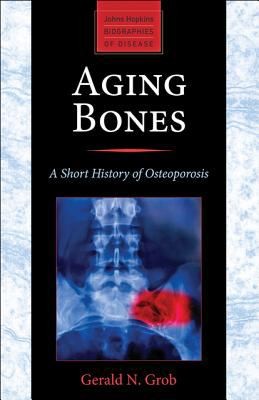 Cover for Aging Bones
            
                Johns Hopkins Biographies of Disease