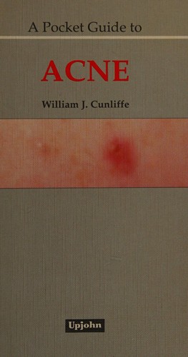 Cover for A Pocket Guide to Acne