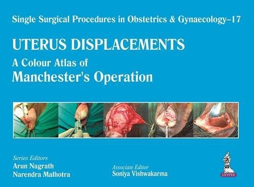 Cover for Single Surgical Procedures in Obstetrics and Gynaecology - 17 - UTERUS DISPLACEMENTS