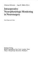 Cover for Intraoperative neurophysiologic monitoring in neurosurgery