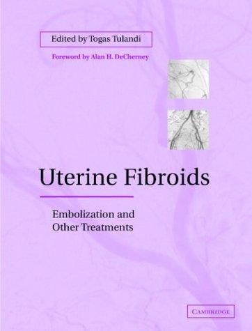 Cover for Uterine Fibroids
