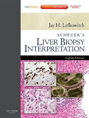 Cover for Scheuers Liver Biopsy Interpretation 9e Expert Consult
