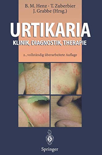Cover for Urtikaria