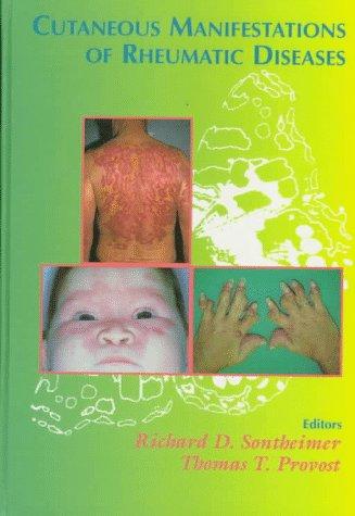 Cover for Cutaneous manifestations of rheumatic diseases