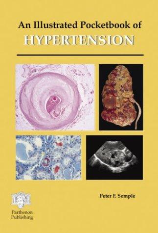 Cover for An illustrated pocketbook of hypertension