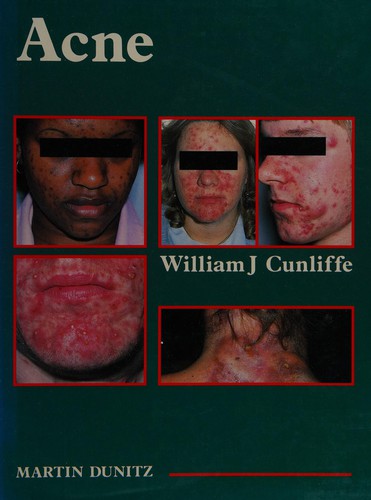 Cover for Acne
