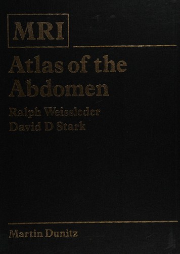 Cover for Mri Atlas of the Abdomen (Mri Atlas Series)