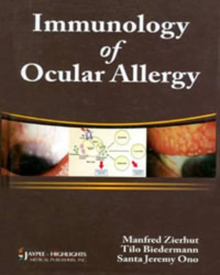 Cover for Immunology Of Ocular Allergy Edited By Manfred Zierhut Tilo Biedermann Santa Jeremy Ono