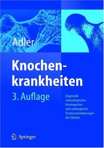 Cover for Knochenkrankheiten