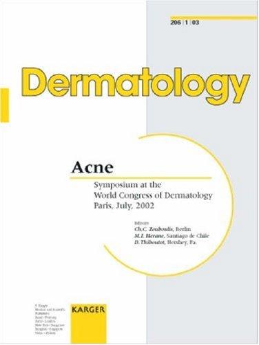 Cover for Acne