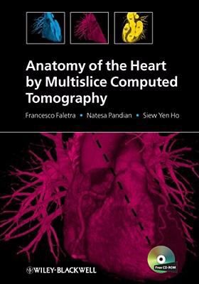 Cover for Anatomy Of The Heart By Multislice Computed Tomography