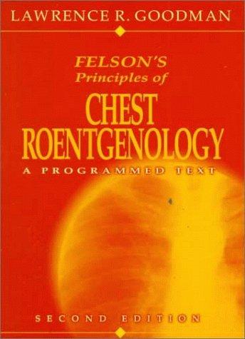 Cover for Felson's principles of chest roentgenology