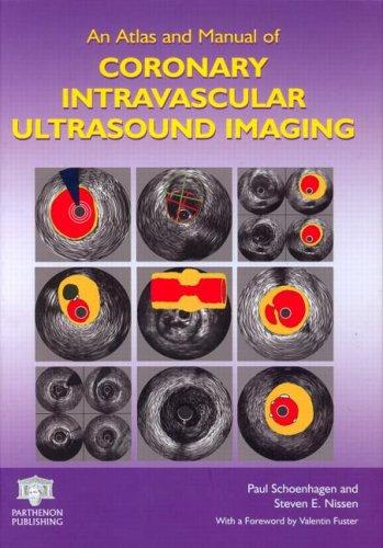 Cover for An Atlas and Manual of Coronary Intravascular Ultrasound Imaging
