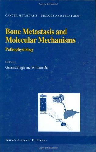Cover for Bone metastasis and molecular mechanisms