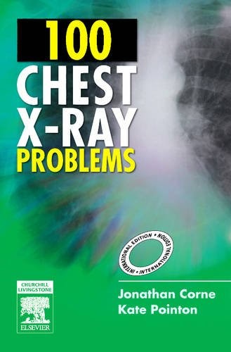 Cover for 100 Chest X-Ray Problems, International Edition