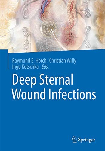 Cover for Deep Sternal Wound Infections