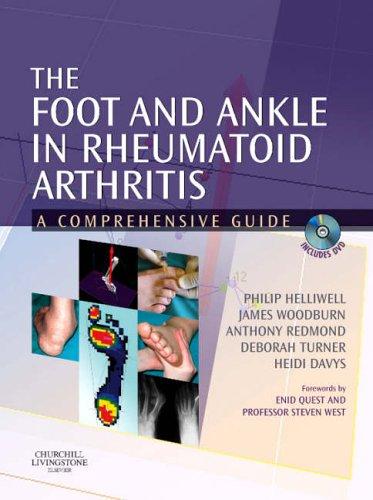 Cover for The Foot and Ankle in Rheumatoid Arthritis