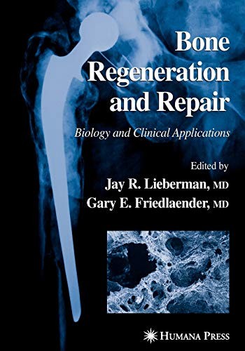Cover for Bone Regeneration and Repair