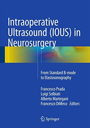 Cover for Intraoperative Ultrasound  in Neurosurgery