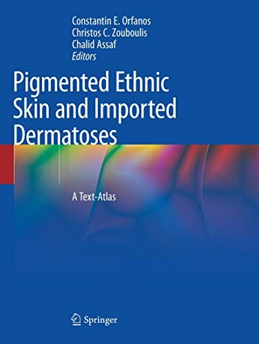 Cover for Pigmented Ethnic Skin and Imported Dermatoses