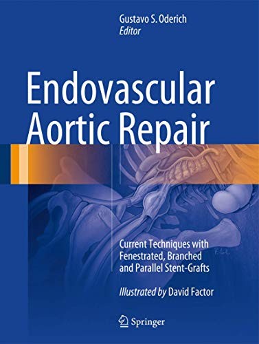 Cover for Endovascular Aortic Repair