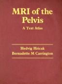 Cover for MRI of the pelvis