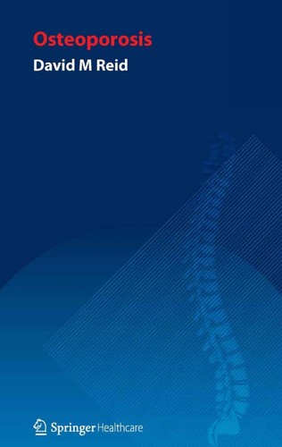Cover for Handbook of Osteoporosis