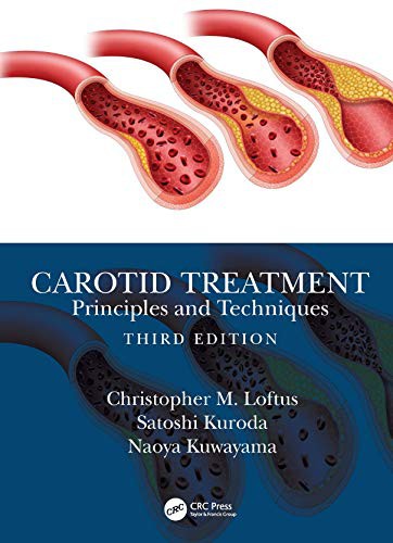Cover for Carotid Treatment